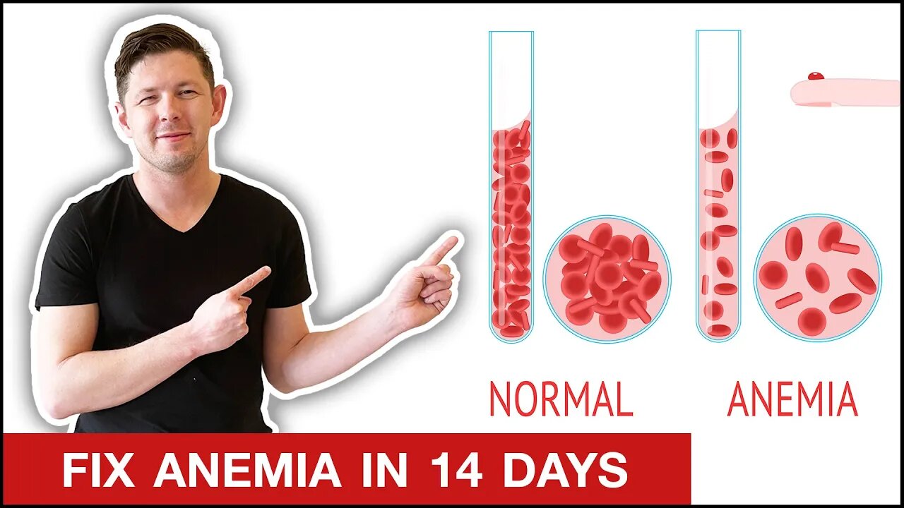 How To Heal Anemia & Low Red Blood Cell Count with Colitis || +15 lbs. in 2 Weeks