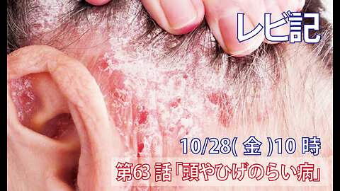 ｢頭や髭のらい病｣(レビ13.29-37)みことば福音教会2022.10.28(金)