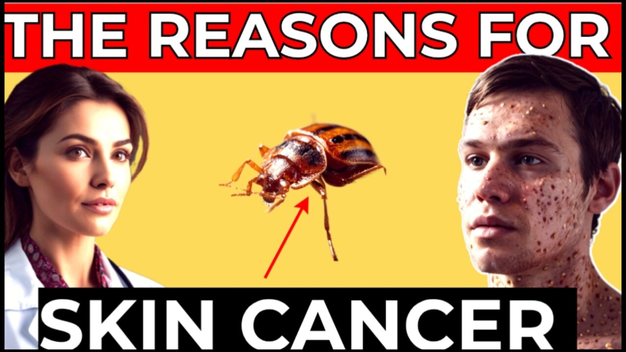 How To Avoid Skin Cancer & Ways To Cure it On Early Stage When Contacted.
