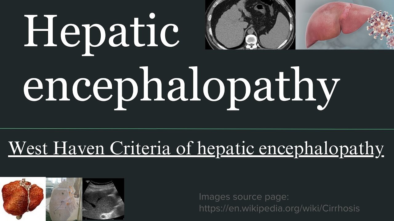 Grades of Hepatic Encephalopathy | West Haven Criteria & Liver Disease Effect on Brain |Novice Medic