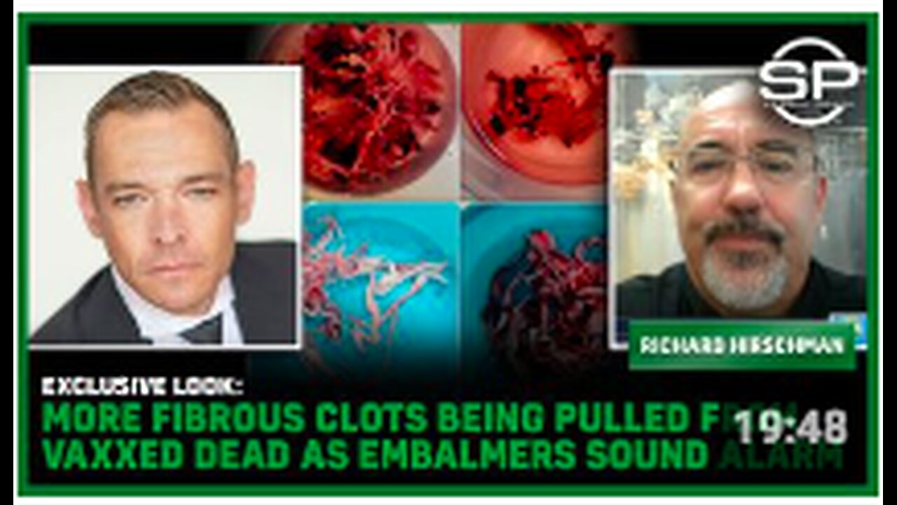 EXCLUSIVE LOOK: MORE Fibrous Clots Being Pulled From Vaxxed DEAD As Embalmers Sound Alarm