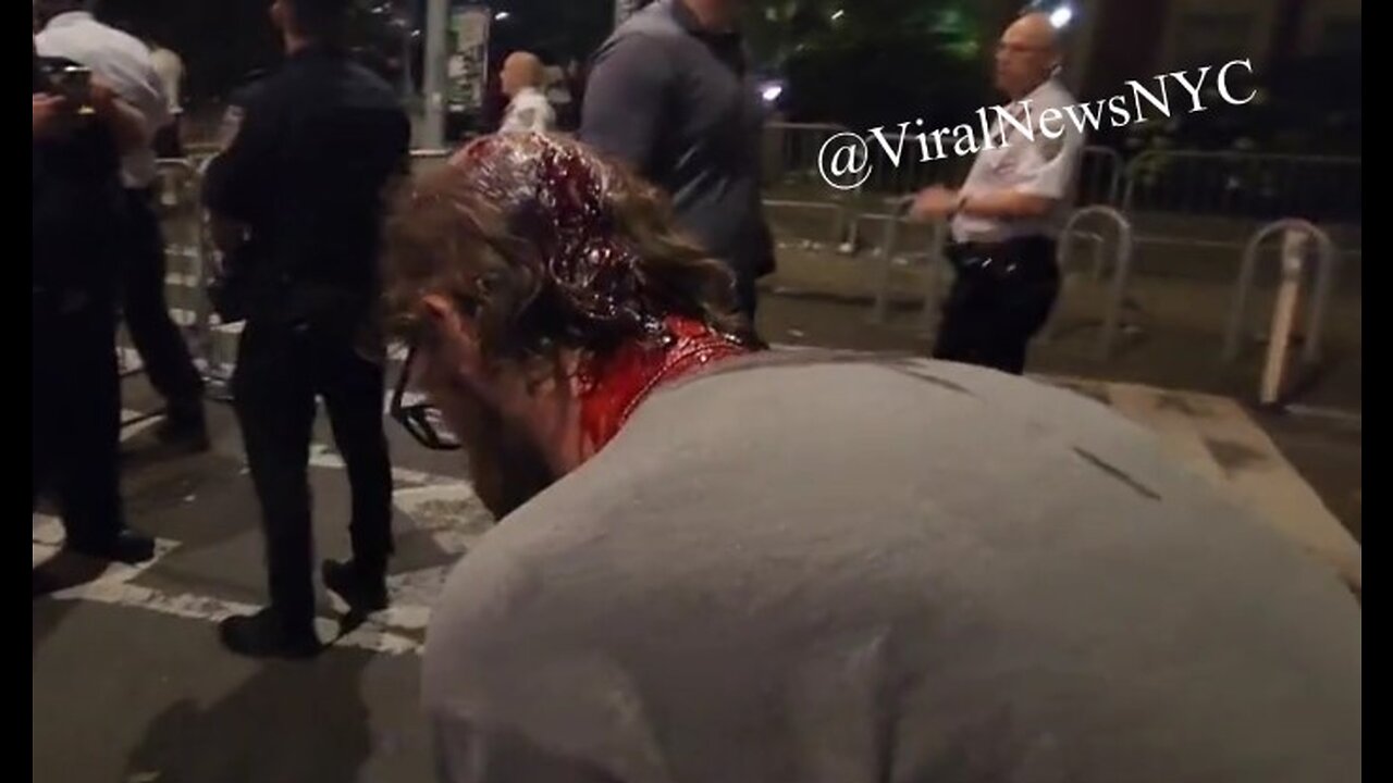 NYC Pride: Violent Animal Smashed a Large Bottle Over My Head! Week in Hospital for Brain Bleed