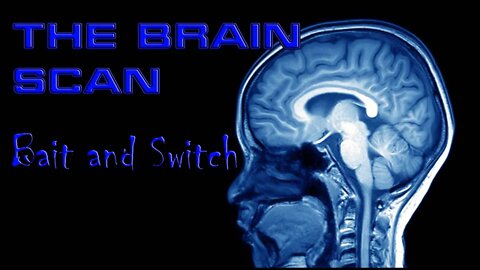 The Brain Scan bait-and-switch: how transvestites misuse science to erase true transsexuals.