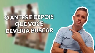 QUER VER UM ANTES E DEPOIS INCRÍVEL?