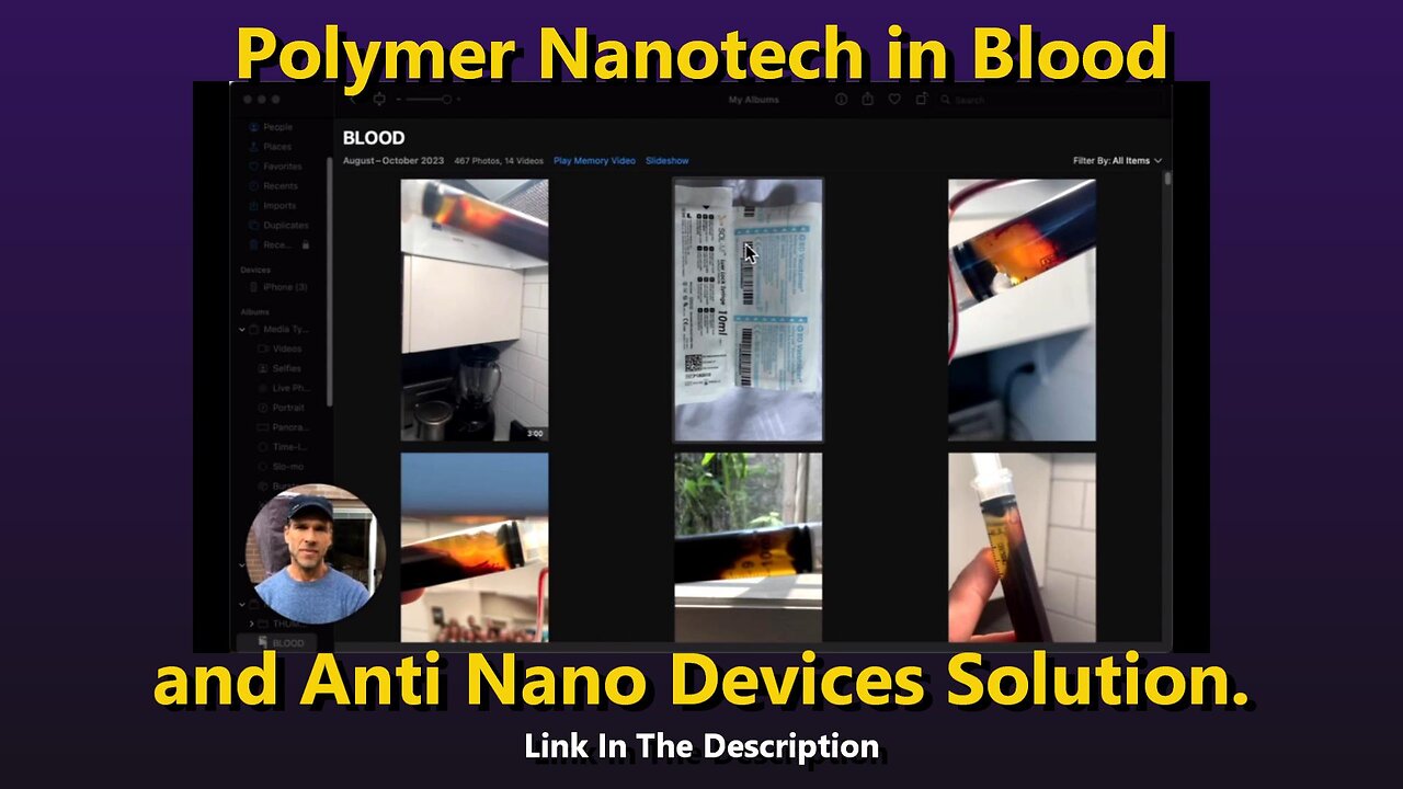 Polymer Nanotech in Blood and Anti Nano Devices Solution.