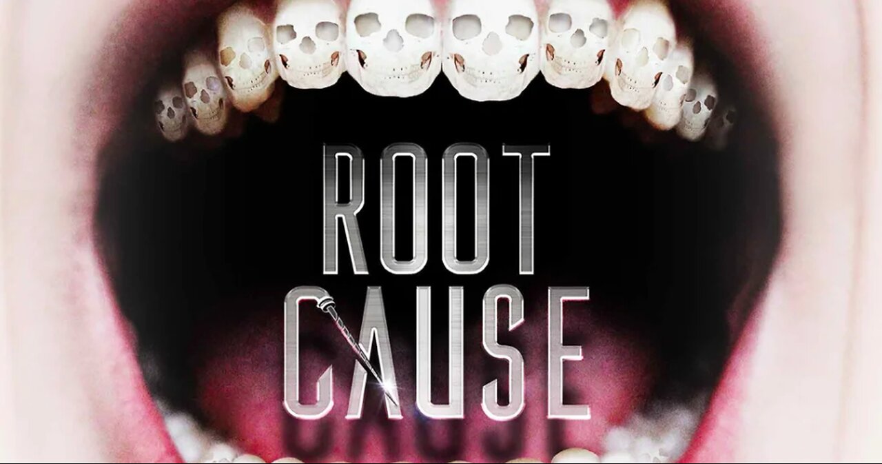 Root Cause