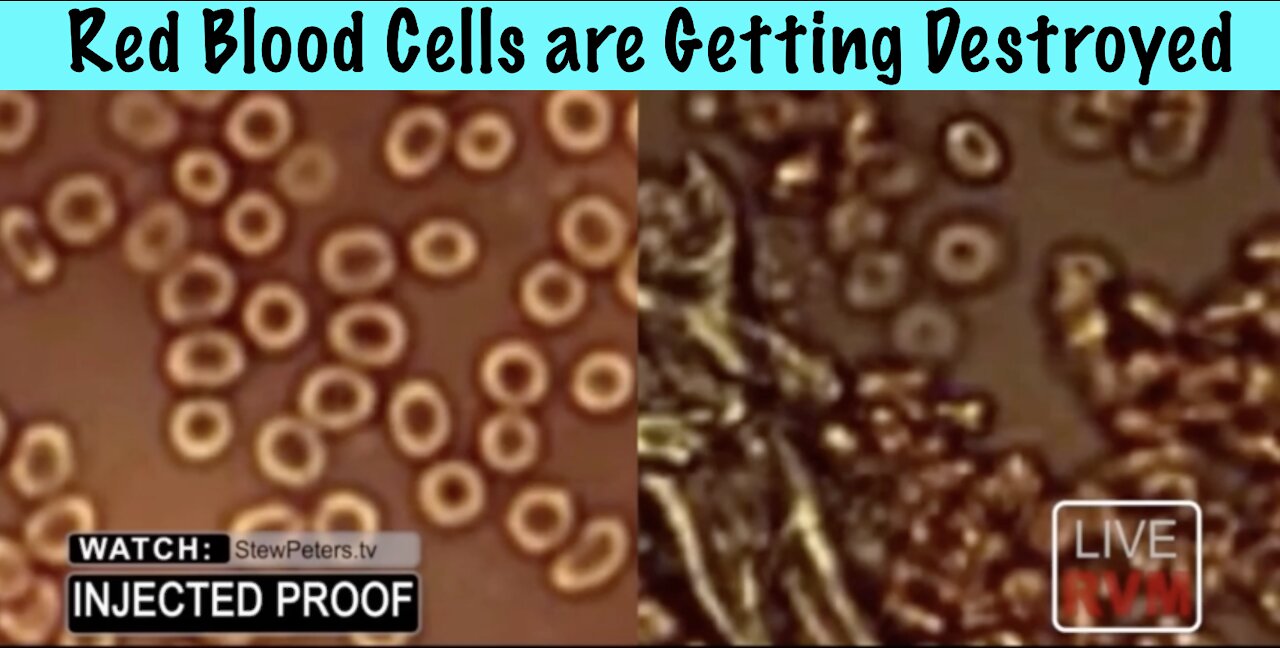 What do the Red Blood Cells look like before and After the Covid Death Shot