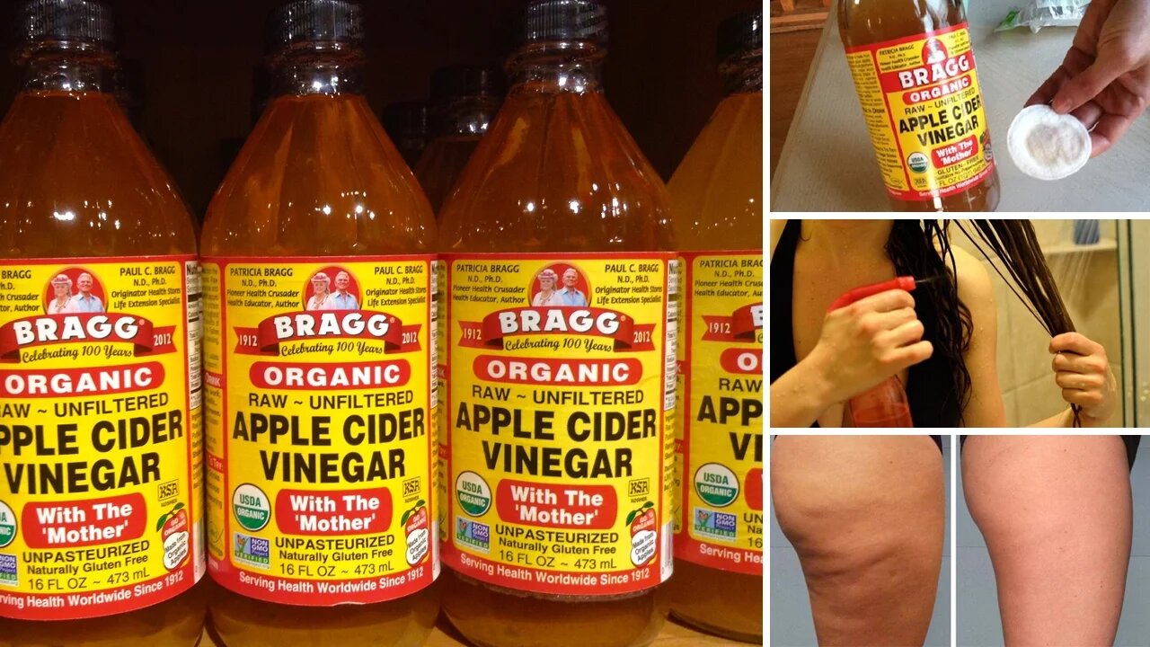 7 Surprising Beauty Benefits of Apple Cider Vinegar