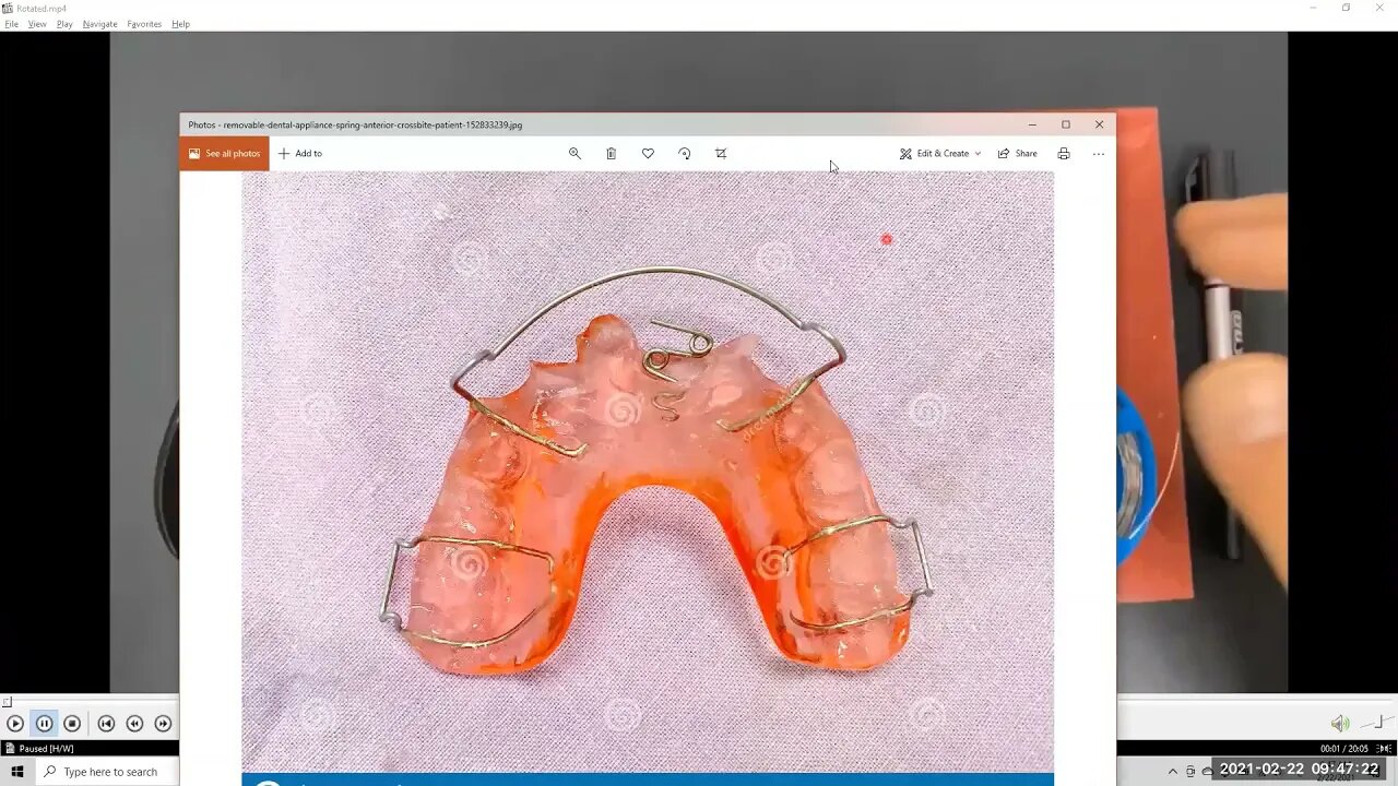 Orthodontic applience (wire bending Z spring demo)