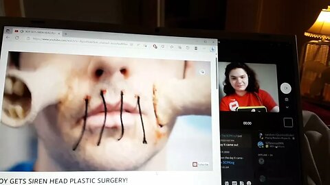 Reaction to BOY GETS SIREN HEAD PLASTIC SURGERY By JesseAndMike