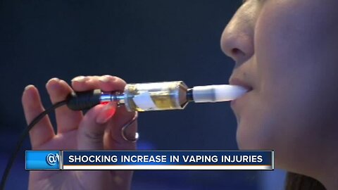 Suspected vaping injuries skyrocket in Wisconsin