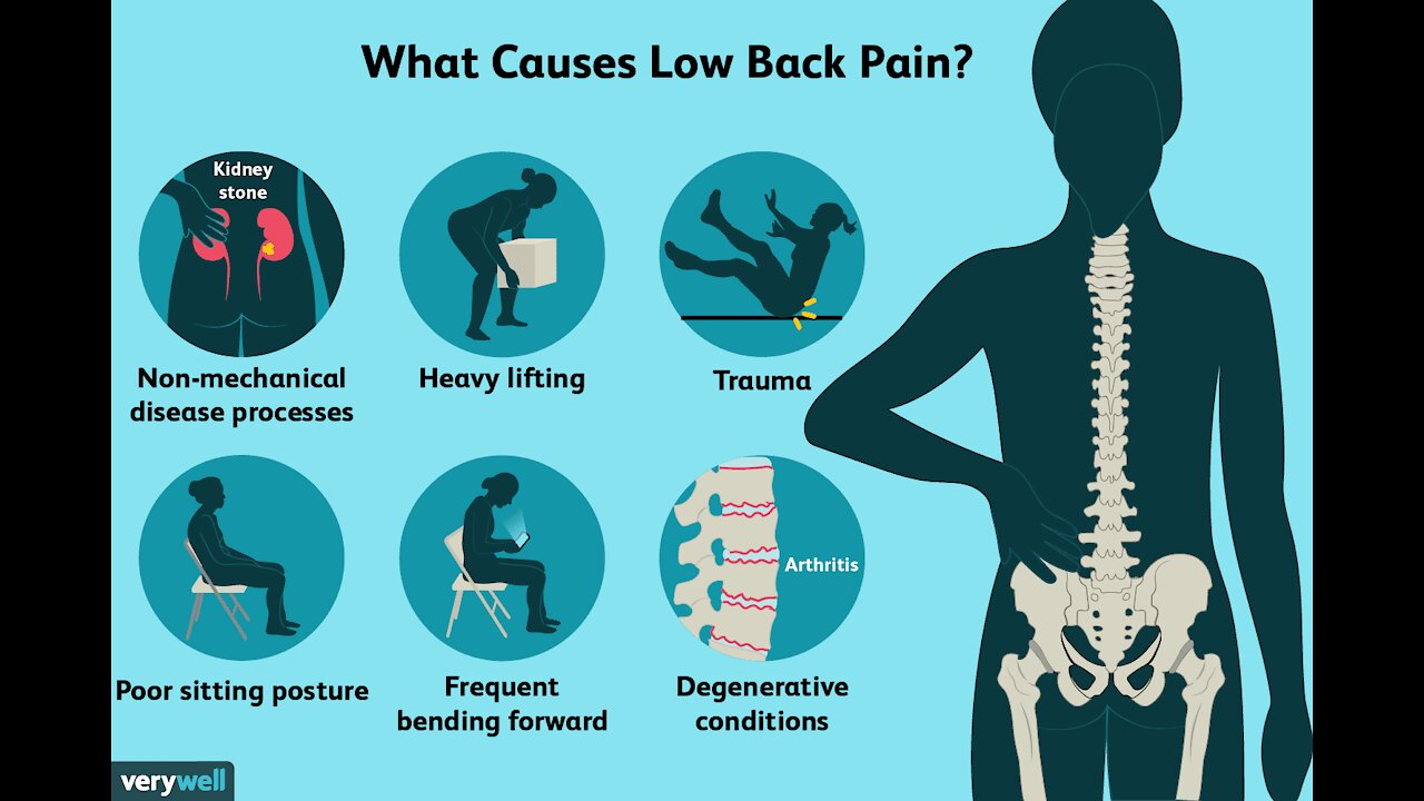 The Back Pain Breakthrough Review 🙌 | [Exercise 🤳 Workout System]