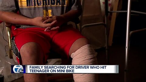 Family searching for driver who hit teenager on minibike