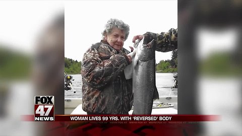 She lived for 99 years with organs in all the wrong places and never knew it