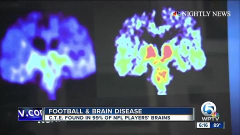 Reactions to new study on brain disease linked to football injuries