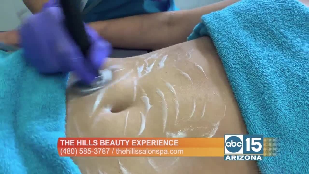 The Hills Beauty Experience: Lose the inches with Body Revive