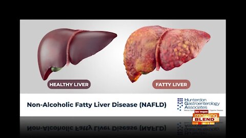 Three Ways Fatty Liver Stops Weight Loss