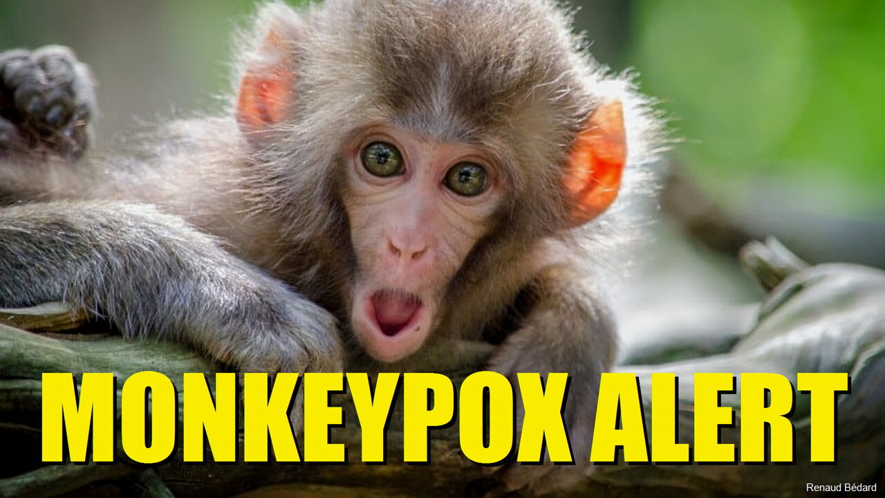 MONKEYPOX ALERT START PANICKING