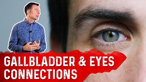 The Link Between the Gallbladder and Eyes – Dr. Berg