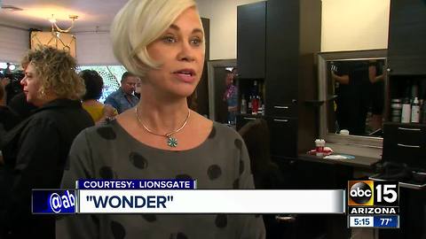 Hollywood movie "Wonder" to shed light on a rare condition