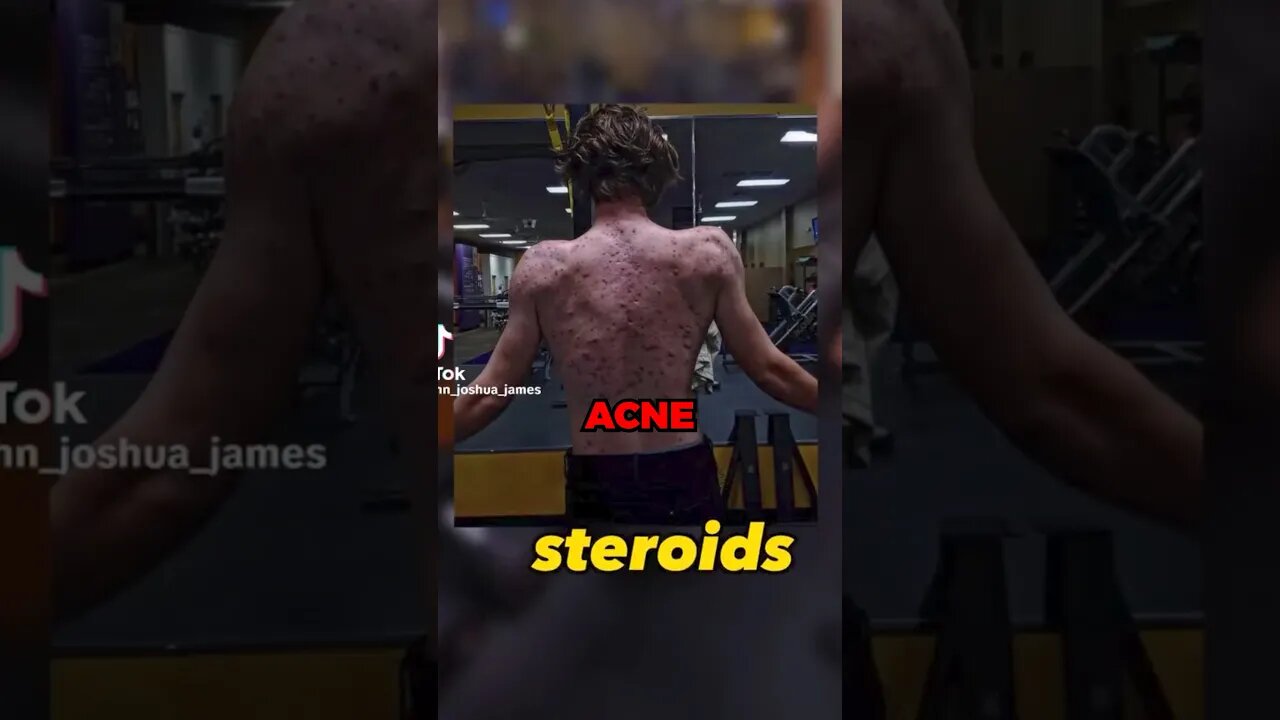 Steroids Have Ruined His Back… #gym #fitness #bodybuilding