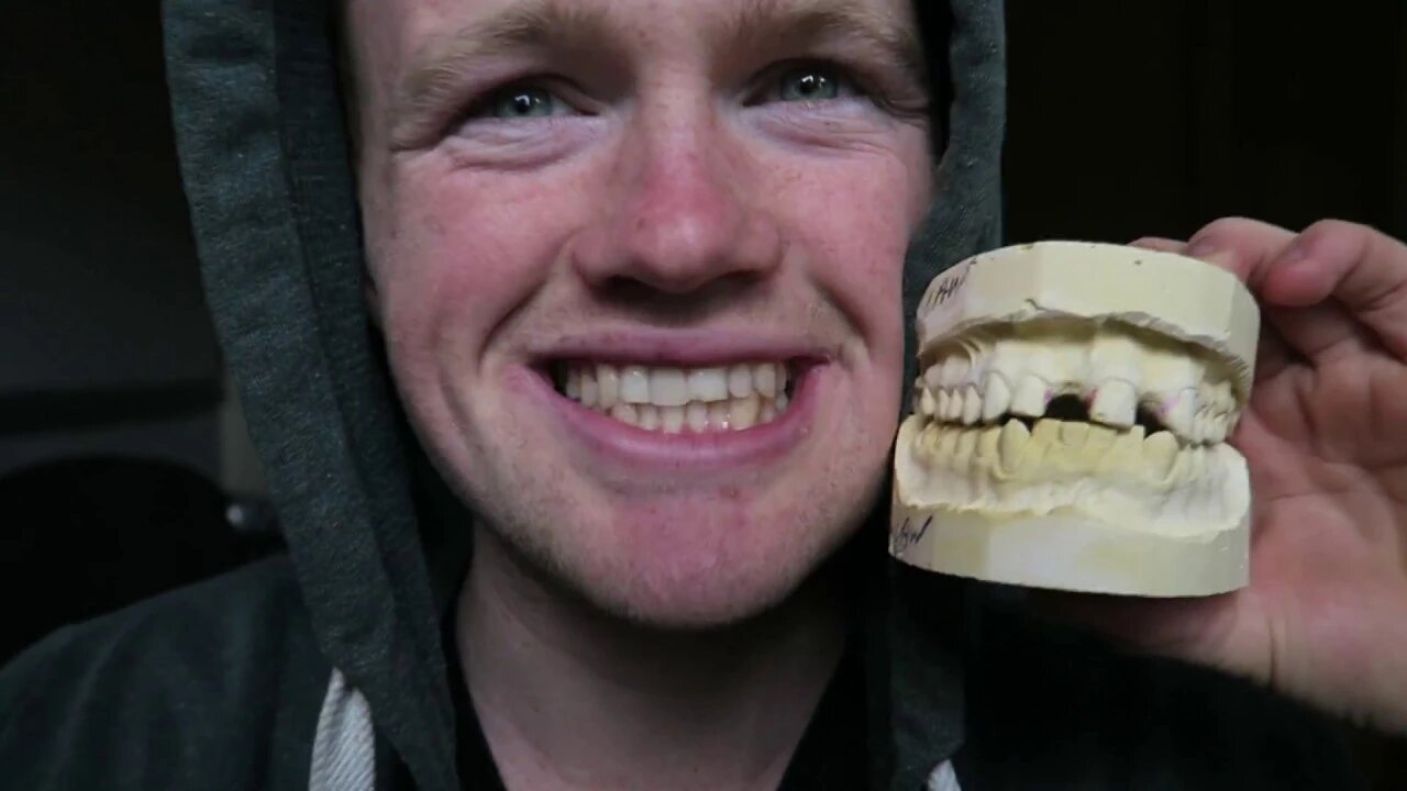 I FINALLY GOT MY TEETH FIXED!