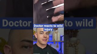 Doctor reacts to crazy injury!