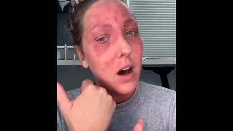 Vaccine Triggers Dormant Health Issues / News They Don’t Want You To Hear