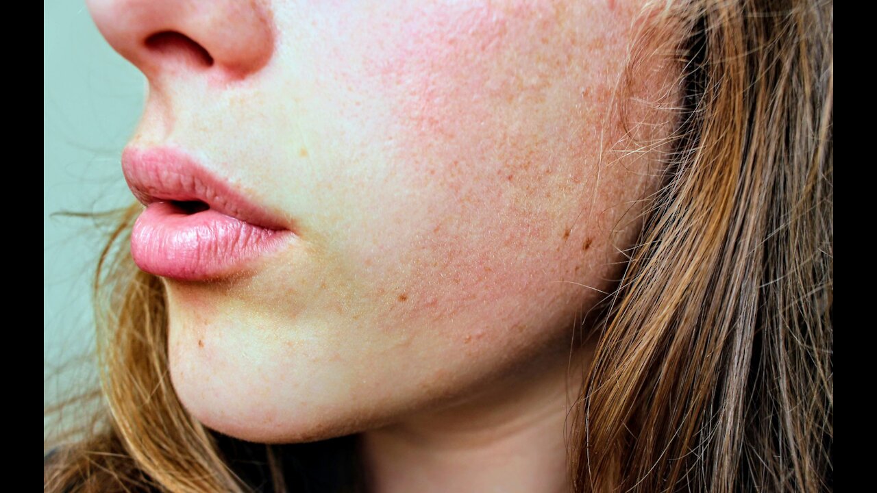 How to treat itching from diabetes, itching from diabetes