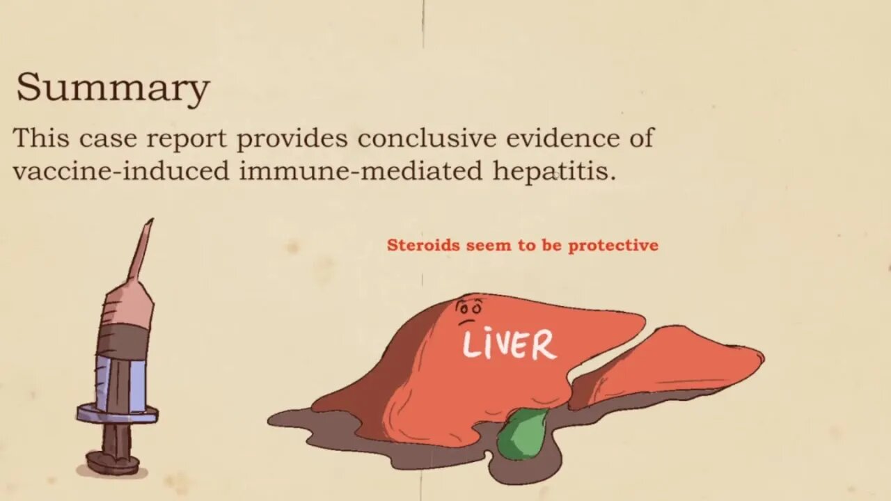 Liver Injury Caused By Moderna Vaccine (Case Report)