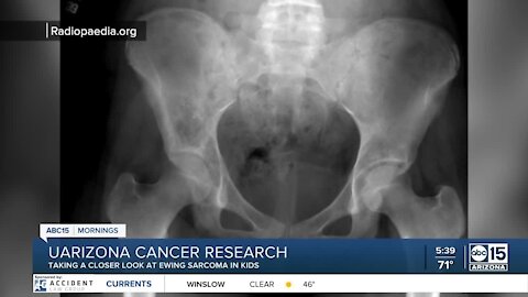 UArizona scientists working to crack the cancer code