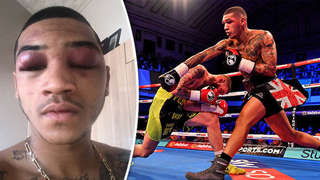 Conor Benn's NASTY Post-Fight Face Will Make You Think He Lost