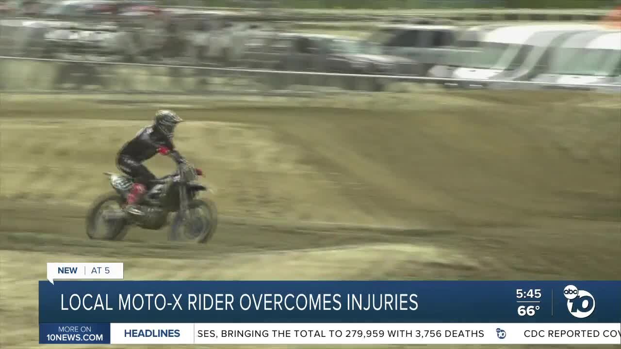 El Cajon native overcomes injuries in motocross