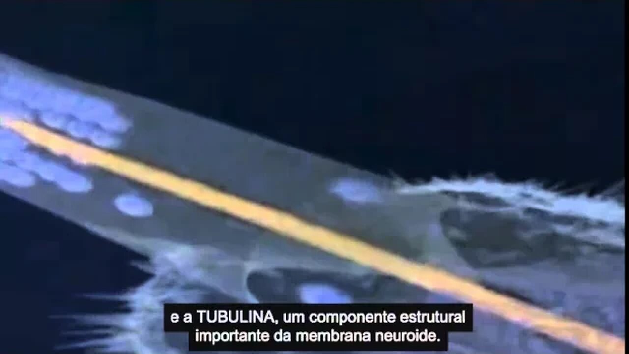Summary of U of C Neuro-degeneration caused by mercury (Portuguese subtitles).