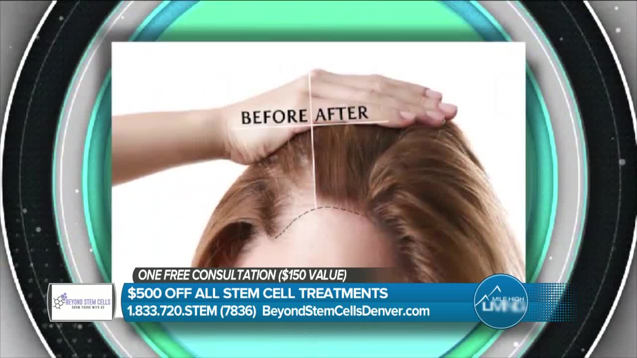 Beyond Stem Cells - Build Your Confidence by Learning about Hair Regrowth.