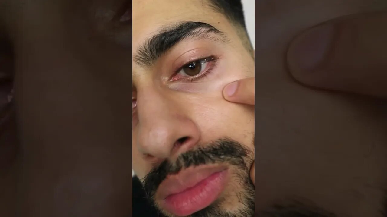 How to Get Rid of Eye Bags and Dark Circles in 15 seconds #shorts