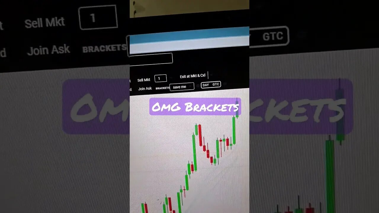 Is futures stop lost brackets and must