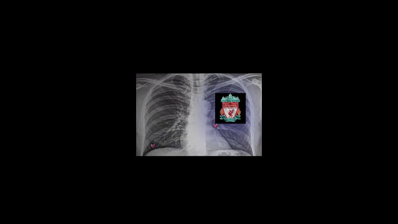 Liverpool is my heart