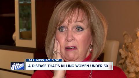 Women missing the signs of a heart attack