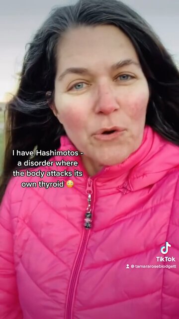 My mom had RA so I’m stressing about #autoimmune BS #tamararoseblodgett