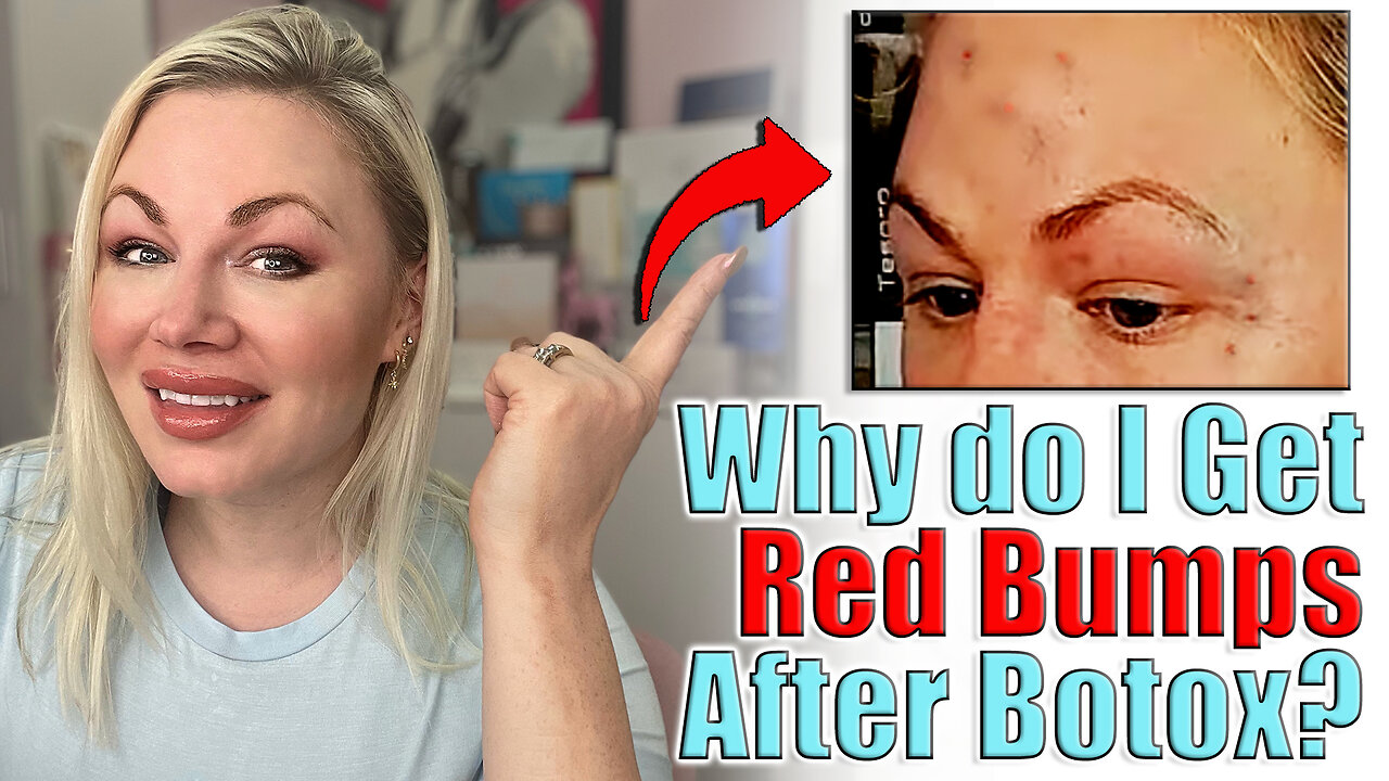 Why Do I Get Red Bumps After Botox? | Code Jessica10 saves you Money at All Approved Vendors