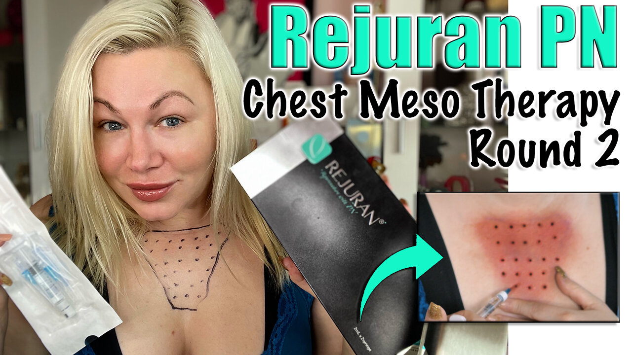 Rejuran PN Chest Meso Therapy: Round 2 from Acecosm.com | Code Jessica10 Saves you Money!