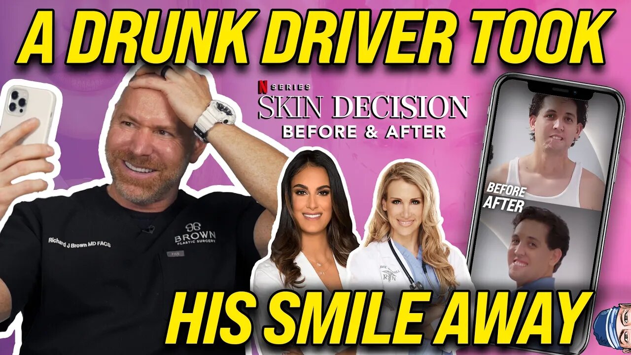 Drunk Driver Took His Smile Away