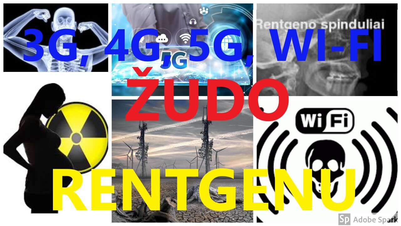 INTERNETO RENTGENO SPINDULIUOTE MIESTE IR KAIME