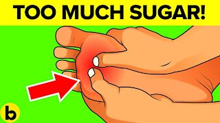 8 Warning Signs That You Are Eating Too Much Sugar