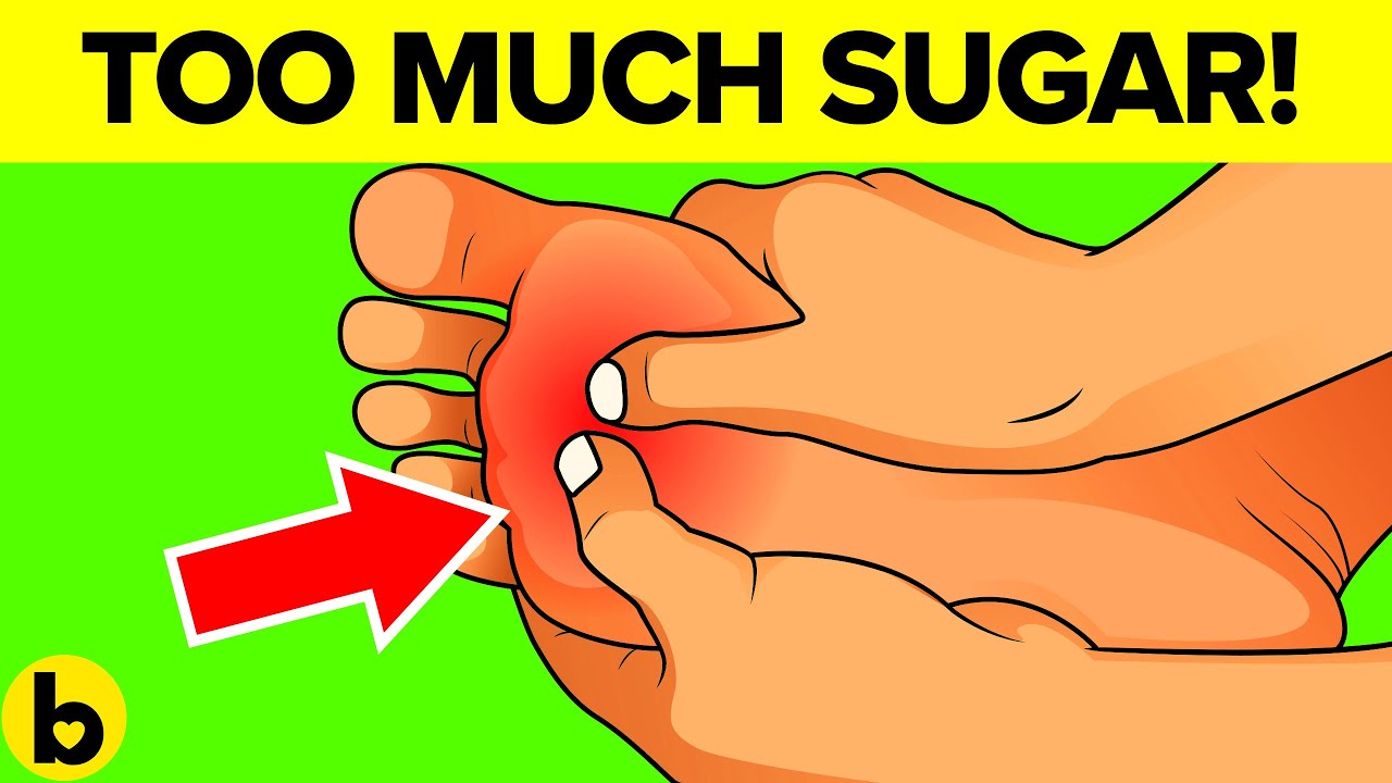 8 Warning Signs That You Are Eating Too Much Sugar