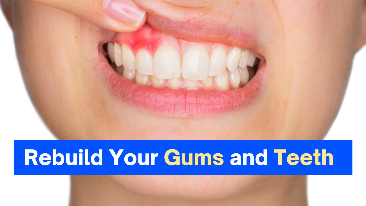 How To Cure Bleeding Gums