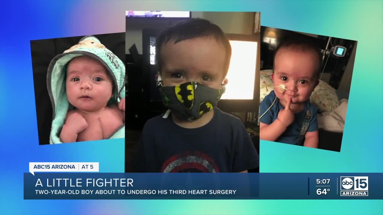 Two-year-old boy about to undergo third heart surgery