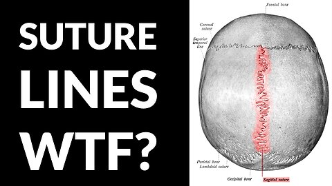 Why Do We Have Suture Lines? Elongated Skulls & Simulated Reality