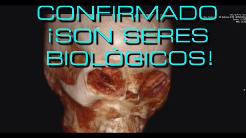 A.M.! CONFIRMADO, SON SERES BIOLÓGICOS